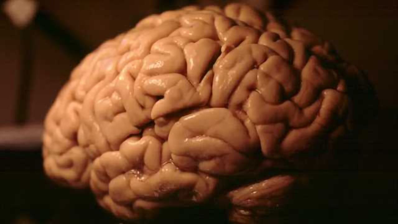 Differences in brain expression of RORA gene may contribute to sex bias in autism