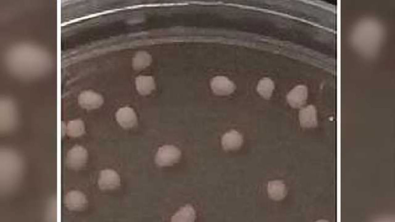 A patient’s budding cortex — in a dish?