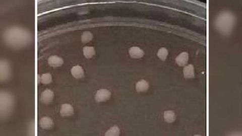 A patient’s budding cortex — in a dish?
