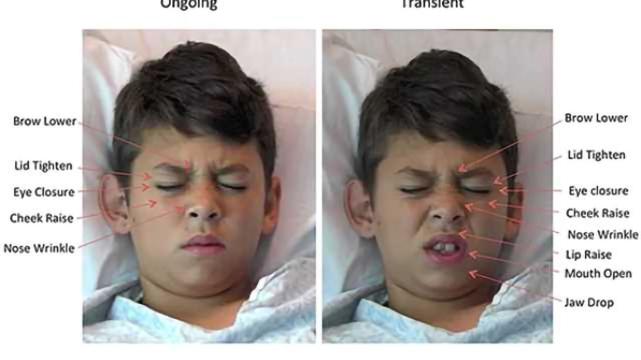 Staring pain in the face – Software “reads” kids’ expressions to measure pain levels
