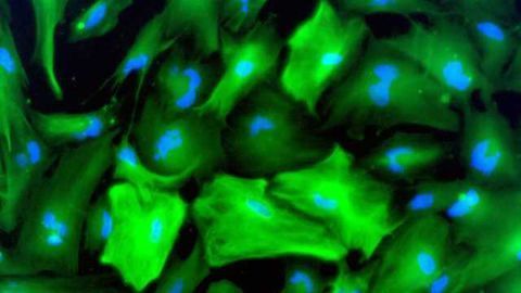 Study on astrocytes brings us toward better understanding of the mechanisms of depression