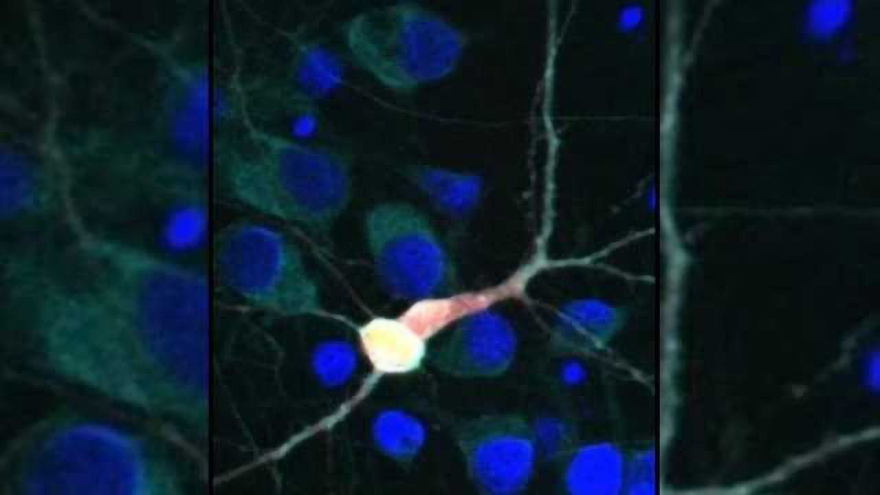 Scientists identify new drug target to treat ALS