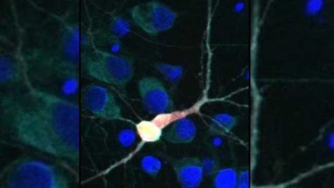 Scientists identify new drug target to treat ALS