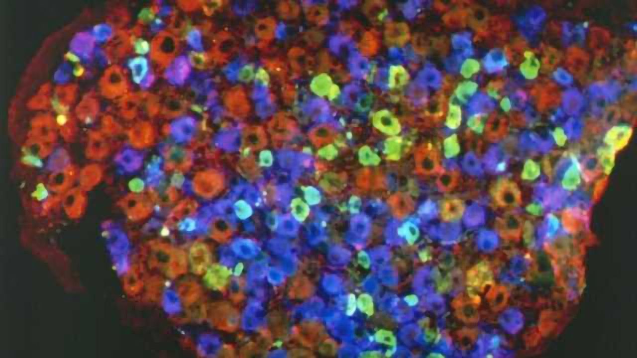 Study links brain inflammation triggered by chronic pain to anxiety and depression