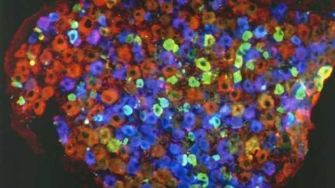 Study links brain inflammation triggered by chronic pain to anxiety and depression