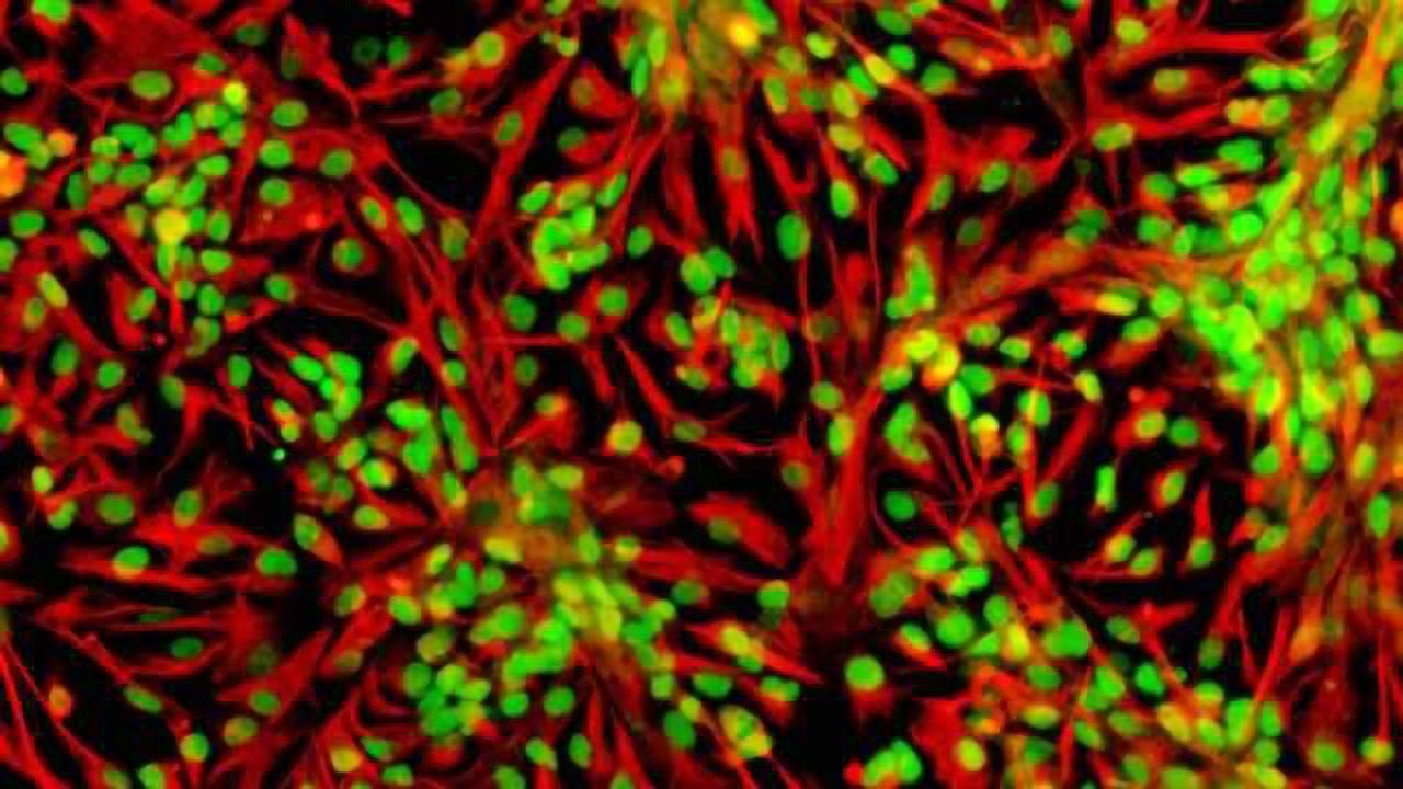 Large doses of antioxidants may be harmful to neuronal stem cells