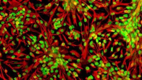 Large doses of antioxidants may be harmful to neuronal stem cells