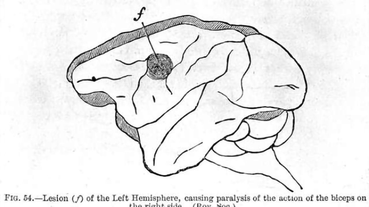 Brain lesions in children challenging to diagnose