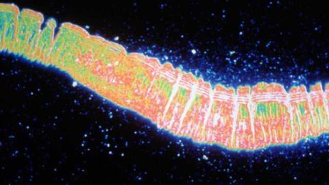 Study on nematode model of ALS offers new treatment hope
