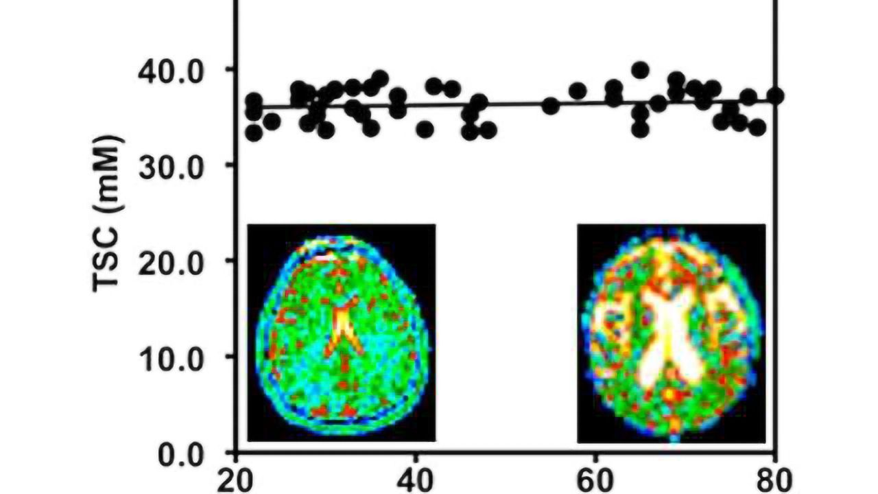 Cell density remains constant as brain shrinks with age