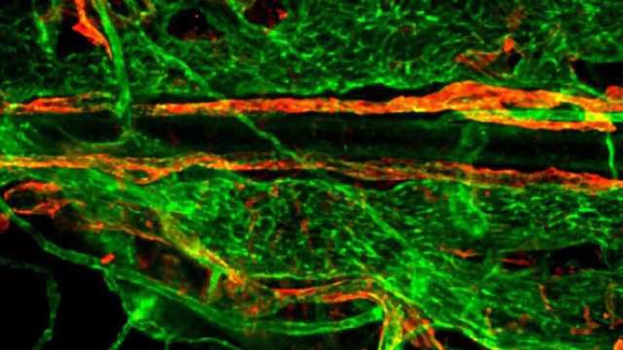 Unraveling the link between brain and lymphatic system