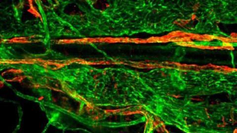 Unraveling the link between brain and lymphatic system