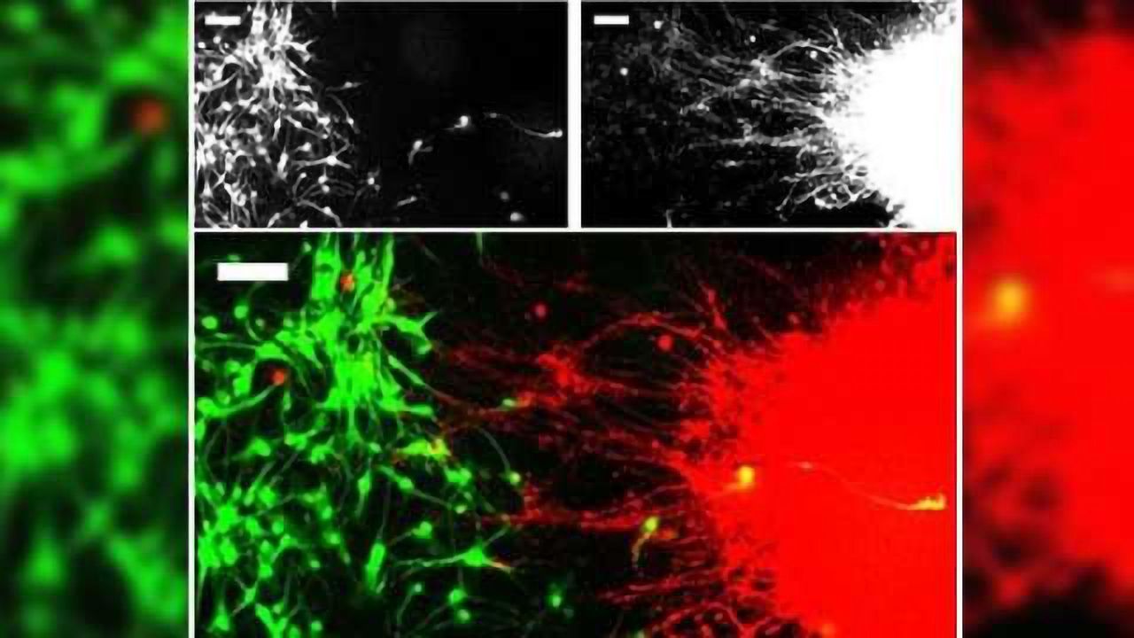 Scientists grow multiple brain structures and make connections between them