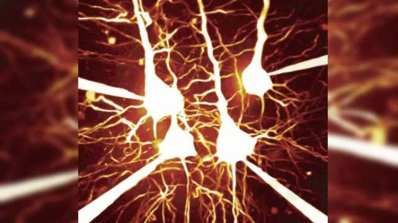 Interactions between cortical and subcortical regions important in hypersensitivity in ASD