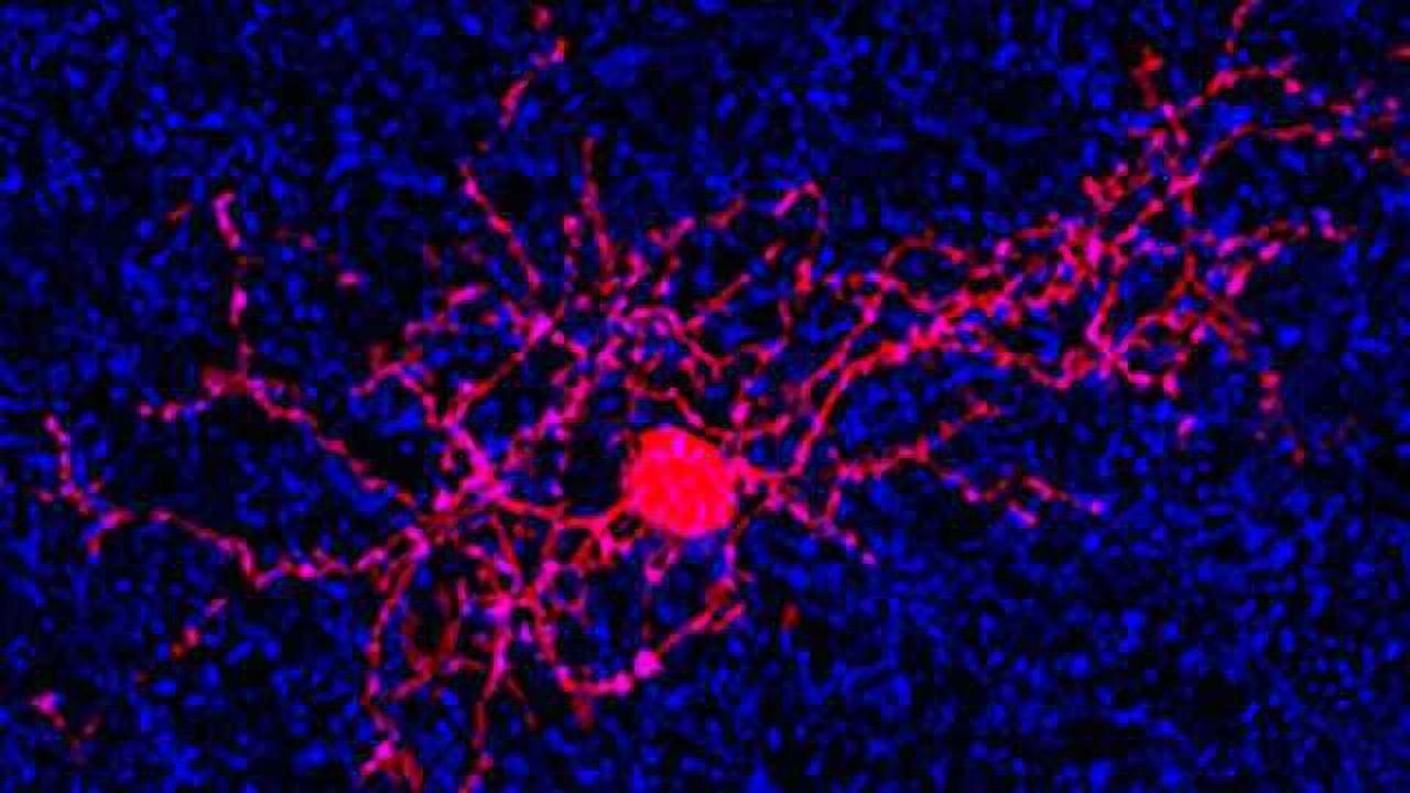 Eye’s motion detection sensors identified