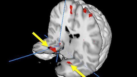 Brain scans of passengers who experienced nightmare flight offer new clues about trauma memory