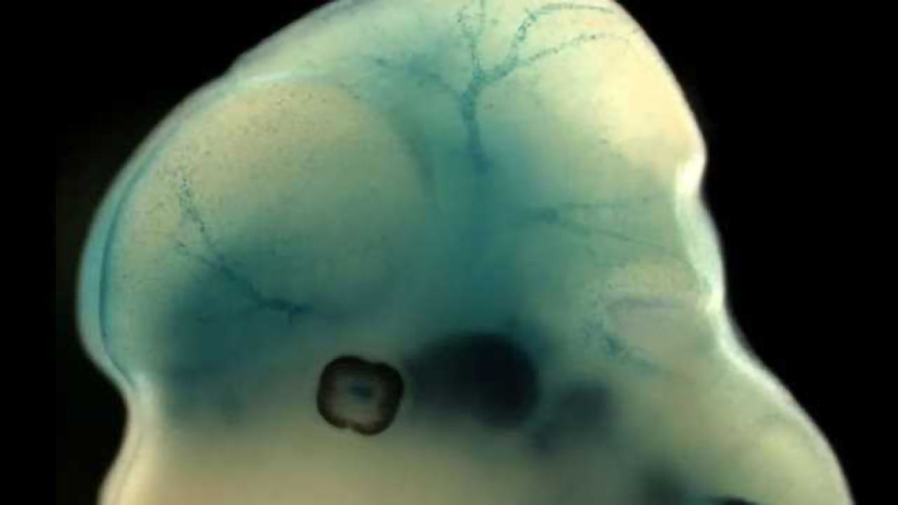 Key protein may affect risk of stroke