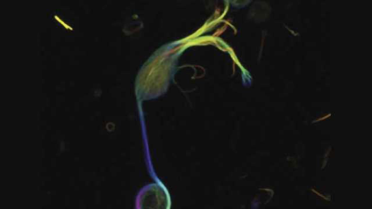 A microtubule 'roadway' in the retina helps provide energy for vision