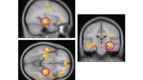 Research reveals how the human brain might reconstruct past events