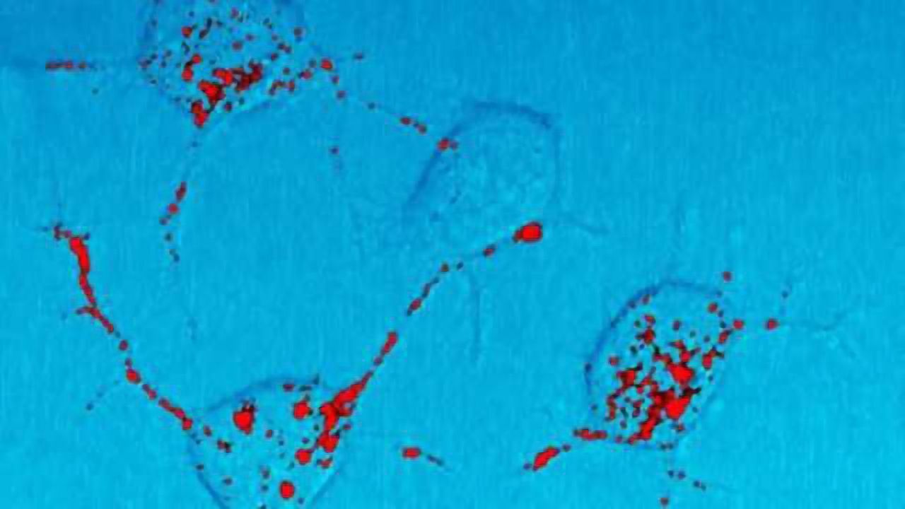 Prion trials and tribulations: Finding the right tools and experimental models