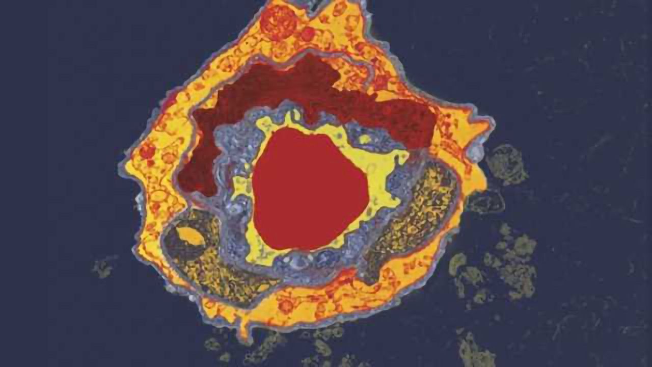Age-related cognitive decline tied to immune-system molecule