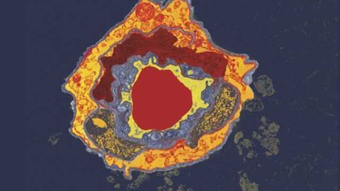 Age-related cognitive decline tied to immune-system molecule