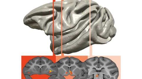 Brain imaging shows how children inherit their parents’ anxiety