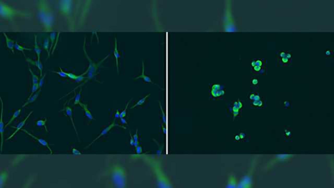 Epigenetic driver of glioblastoma provides new therapeutic target