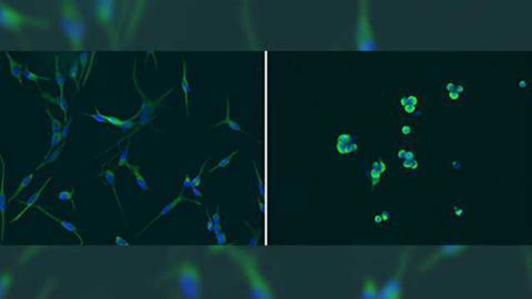 Epigenetic driver of glioblastoma provides new therapeutic target