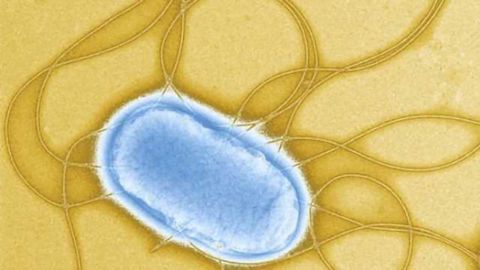 Research team finds bacterial biofilms may play a role in lupus, MS, other auto-immune diseases