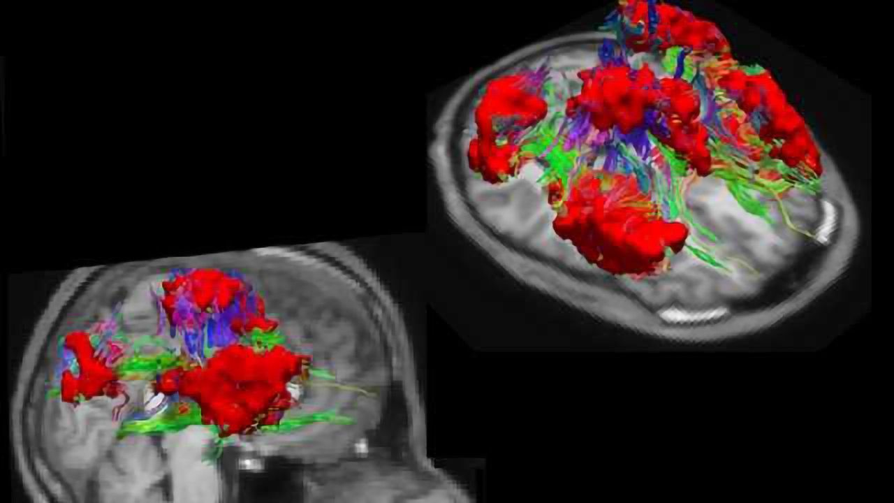 A new atlas of the brain opens up alternative means for studying brain disorders