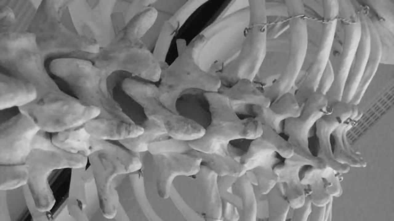 Findings identify receptors modulating macrophage responses to spinal cord injury
