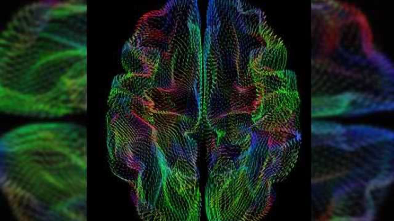 A new wrinkle: Geometry of brain’s outer surface correlates with genetic heritage