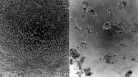 Gene therapy advance thwarts brain cancer in rats