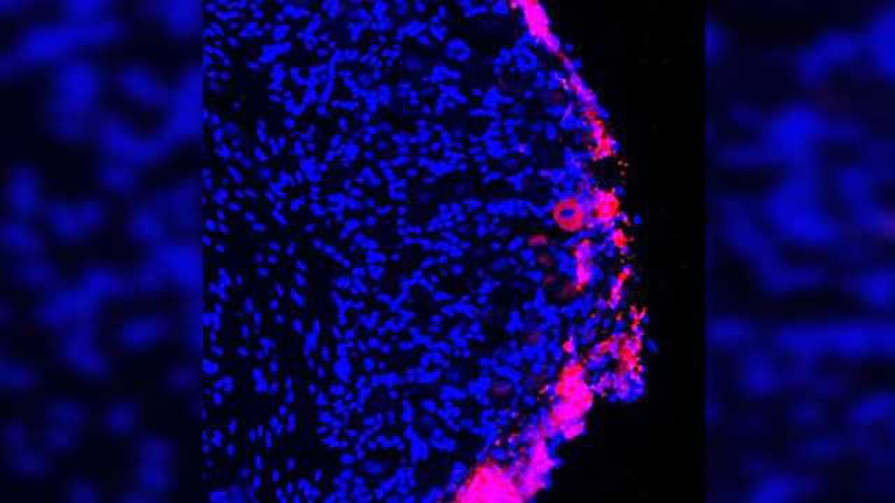Stem cells provide lasting pain relief in mice
