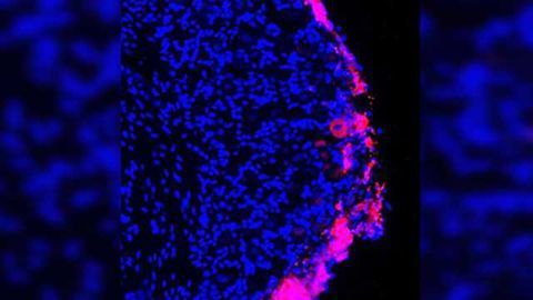 Stem cells provide lasting pain relief in mice