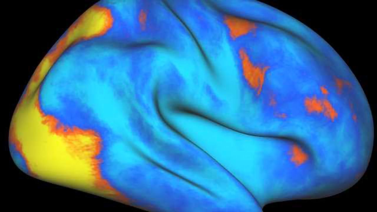 Brain network that controls, redirects attention identified