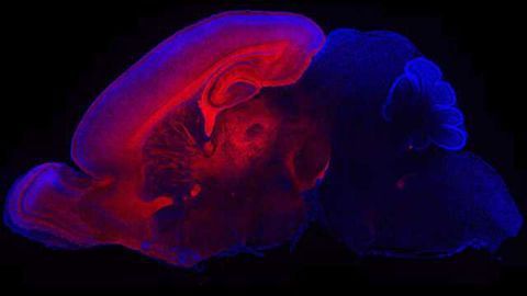 Scientists pinpoint mechanism for altered pattern of brain growth in autism spectrum disorder