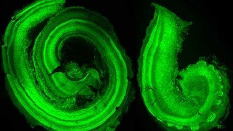 New findings hint toward reversing hearing loss
