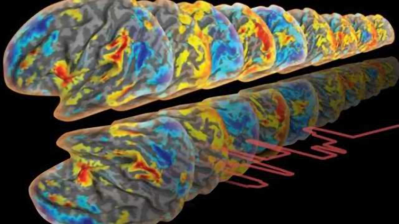Observing brain network dynamics to diagnose Alzheimer's disease
