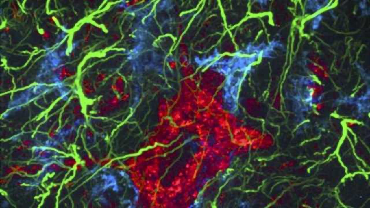 Gut worms protect babies' brains from inflammation