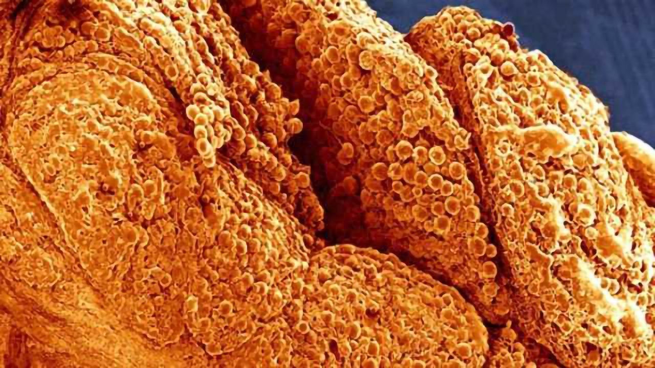 Body fat can send signals to brain, affecting stress response