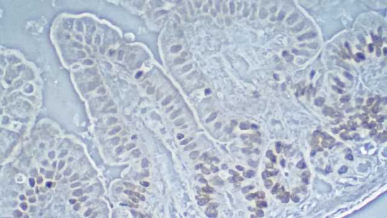 Scientists show a link between intestinal bacteria and depression
