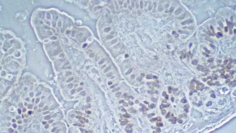 Scientists show a link between intestinal bacteria and depression