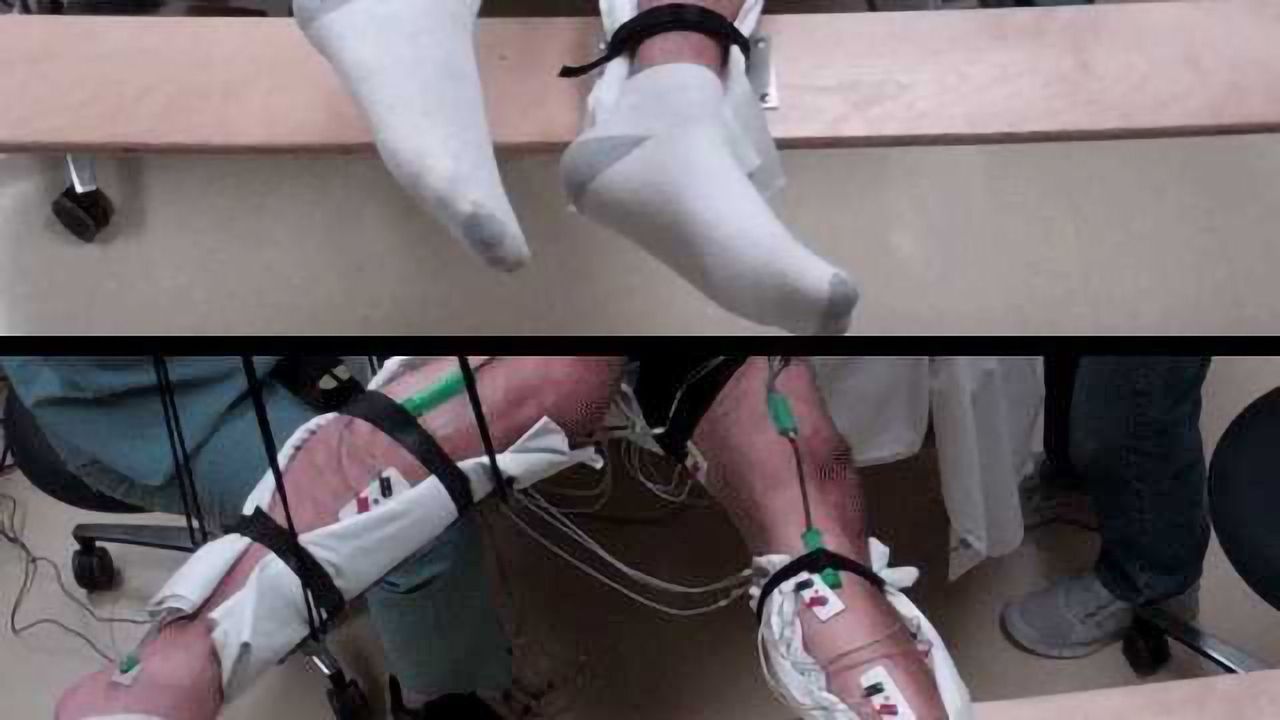 In UCLA study, non-surgical approach helps people with paralysis voluntarily move their legs – a first