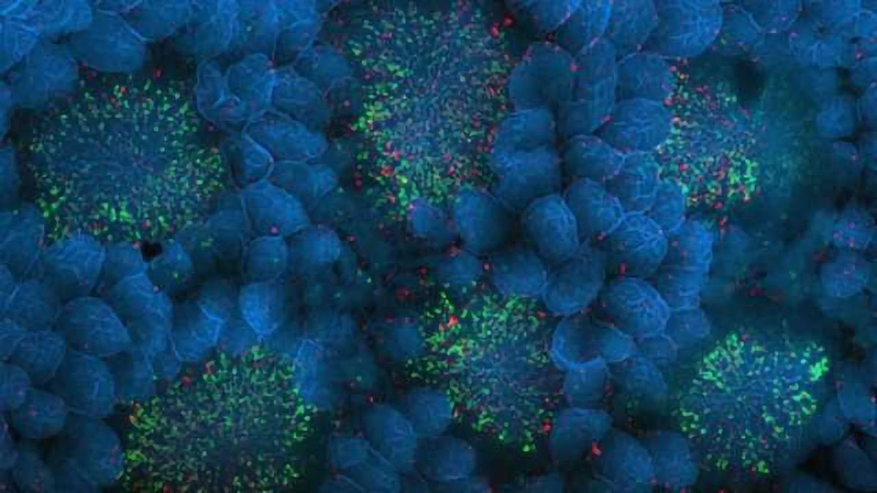 Brain infection starts in gut, study finds