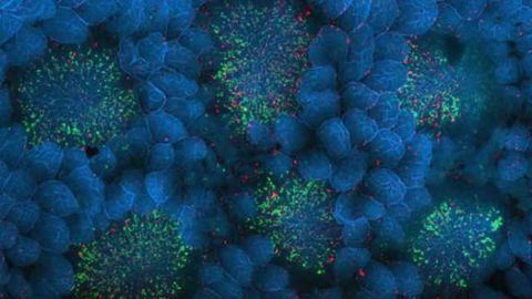 Brain infection starts in gut, study finds