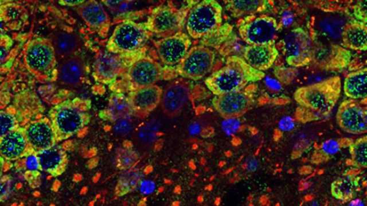 Missing piece surfaces in the puzzle of autism