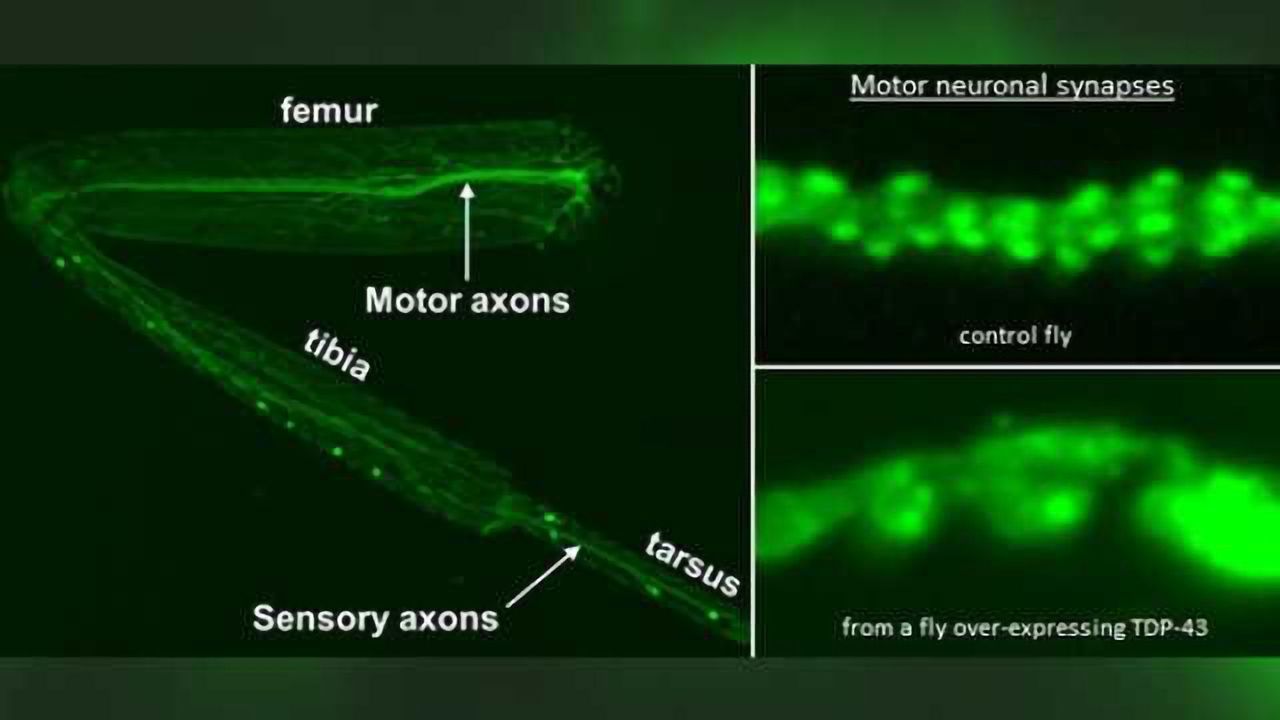 Novel fly model of motor neuron degeneration provides new avenues for exploration in humans