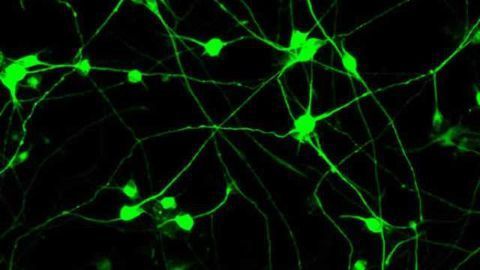 Chemical-only cell reprogramming transforms human and mouse skin cells into neurons